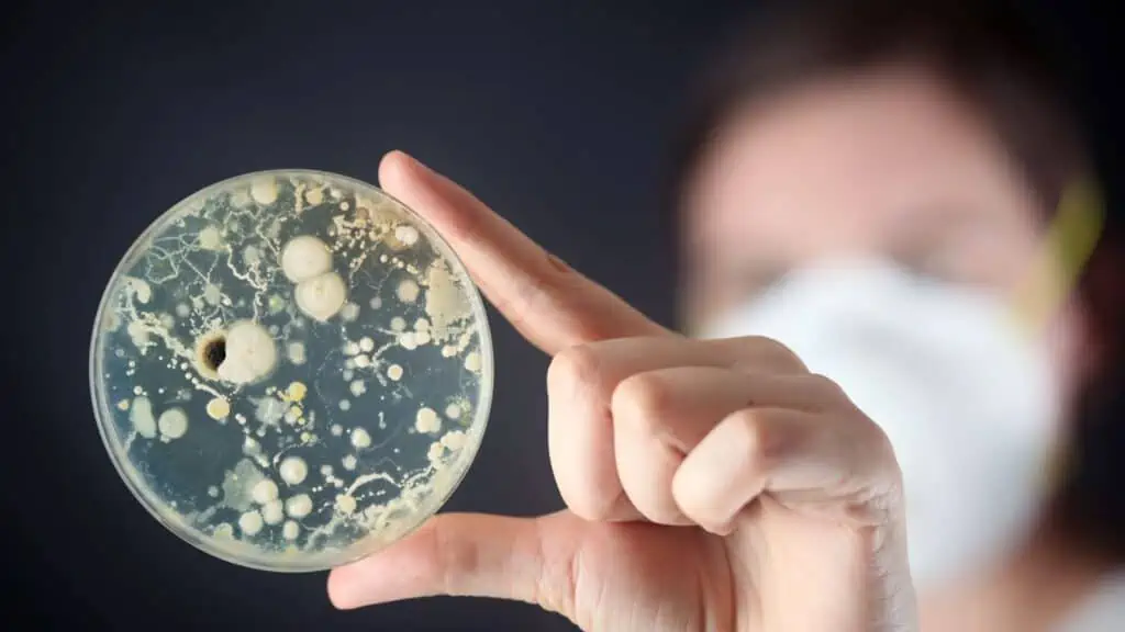 bacteria in a petri dish